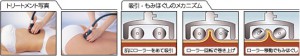 痩身メニューセルバーン